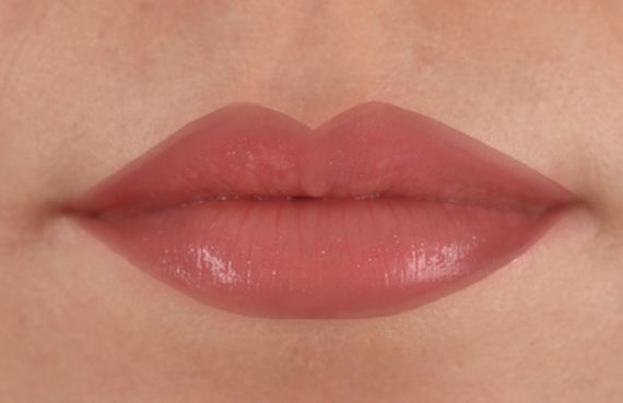 10-Fuller-Lips