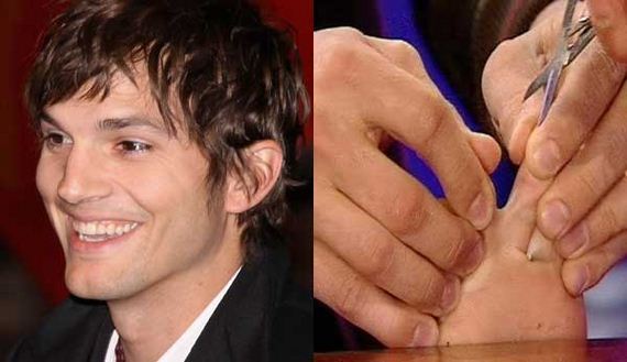 Not only does Ashton Kutcher have webbed toes, he recently showed them off ...